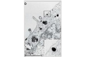 Immunohistochemistry (IHC) image for anti-Epidermal Growth Factor Receptor (EGFR) (Extracellular Domain) antibody (ABIN492658) (EGFR antibody  (Extracellular Domain))