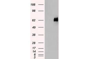 HEK293T cells were transfected with the pCMV6-ENTRY control (Left lane) or pCMV6-ENTRY SILV (Right lane) cDNA for 48 hrs and lysed. (Melanoma gp100 antibody)