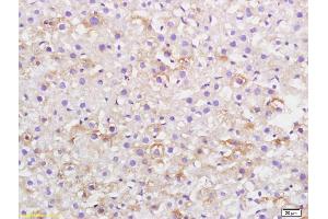 Formalin-fixed and paraffin embedded rat liver labeled with Anti-CKLF Polyclonal Antibody, Unconjugated (ABIN739650) at 1:200, followed by conjugation to the secondary antibody and DAB staining (CKLF antibody  (AA 1-100))