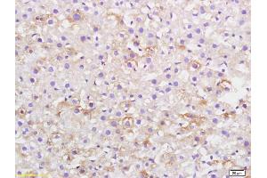 Formalin-fixed and paraffin embedded rat liver labeled with Anti-CKLF Polyclonal Antibody, Unconjugated (ABIN739650) at 1:200, followed by conjugation to the secondary antibody and DAB staining (CKLF antibody  (AA 1-100))