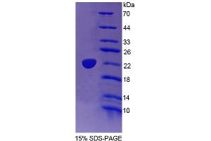 SDS-PAGE (SDS) image for Transcriptional Regulating Factor 1 (TRERF1) (AA 779-936) protein (His tag) (ABIN6239133) (TRERF1 Protein (AA 779-936) (His tag))
