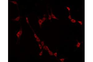 ABIN6275025 staining HuvEc by IF/ICC. (CCDC102B antibody  (Internal Region))