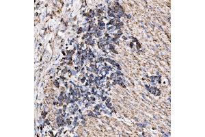IHC analysis of RPL17 using anti-RPL17 antibody (ABIN7601639).