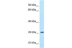 WB Suggested Anti-PPP1R3B Antibody Titration: 1. (PPP1R3B antibody  (N-Term))