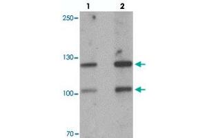 Western blot analysis of CRB2 in rat brain tissue with CRB2 polyclonal antibody  at 1 ug/mL.