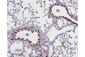 Expression of Adenosine A2A Receptor in rat lung - Immunohistochemical staining of paraffin emedded rat lung sections using Anti-Adenosine A2A Receptor Antibody (ABIN7042883, ABIN7043888 and ABIN7043889), (1:50). (Adenosine A2a Receptor antibody  (AA 201-215))