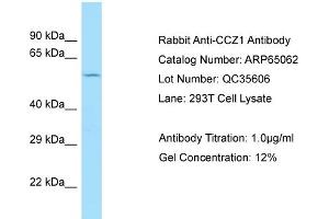 Western Blotting (WB) image for anti-CCZ1 Vacuolar Protein Trafficking and Biogenesis Associated Homolog (S. Cerevisiae) (CCZ1) (C-Term) antibody (ABIN2790029) (CCZ1 antibody  (C-Term))