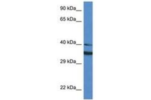 Image no. 1 for anti-NAD(P)H Dehydrogenase, Quinone 1 (NQO1) (AA 111-160) antibody (ABIN6747304)