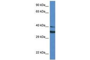 Image no. 1 for anti-NAD(P)H Dehydrogenase, Quinone 1 (NQO1) (AA 111-160) antibody (ABIN6747304) (NQO1 antibody  (AA 111-160))