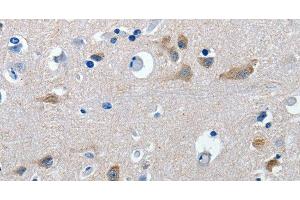 Immunohistochemistry of paraffin-embedded Human brain tissue using GAD2 Polyclonal Antibody at dilution 1:30 (GAD65 antibody)