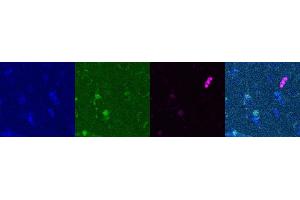 Immunohistochemistry (IHC) image for anti-Somatostatin (SST) antibody (ABIN7455980) (Somatostatin antibody)