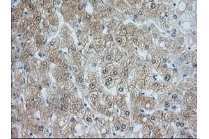 Image no. 2 for anti-Acetyl-CoA Acetyltransferase 2 (ACAT2) antibody (ABIN1496402) (ACAT2 antibody)