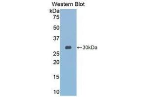 Western Blotting (WB) image for anti-Granzyme K (Granzyme 3, Tryptase II) (GZMK) (AA 27-264) antibody (ABIN1078092) (GZMK antibody  (AA 27-264))