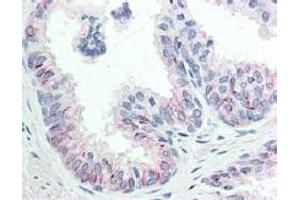 Immunohistochemistry (IHC) image for anti-V-Akt Murine Thymoma Viral Oncogene Homolog 1 (AKT1) (Ser473) antibody (ABIN400784) (AKT1 antibody  (Ser473))