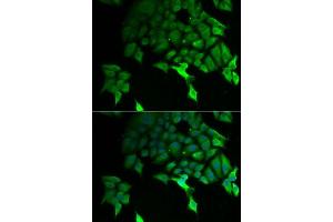 Immunofluorescence analysis of U2OS cells using TSC22D3 antibody.