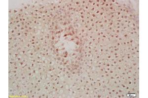 Immunohistochemistry (IHC) image for anti-Macrophage Stimulating 1 (Hepatocyte Growth Factor-Like) (MST1) (AA 385-487) antibody (ABIN747308)
