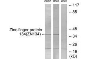 Western blot analysis of extracts from COS7/K562 cells, using ZNF134 Antibody. (ZNF134 antibody  (AA 116-165))