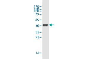 Western Blot detection against Immunogen (44 KDa) . (Epididymal Protein 3A (EDDM3A) (AA 1-147) antibody)