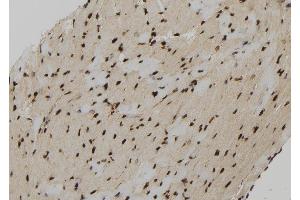 ABIN6279207 at 1/100 staining Mouse heart tissue by IHC-P. (Calcineurin B antibody  (N-Term))
