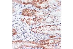 Immunohistochemistry of paraffin-embedded human stomach using Lysozyme (Lysozyme (LYZ)) antibody (ABIN6133802, ABIN6143409, ABIN6143412 and ABIN6217538) at dilution of 1:100 (40x lens). (LYZ antibody  (AA 1-100))