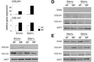 Western Blotting (WB) image for anti-Collagen, Type I (COL1) antibody (ABIN135046)