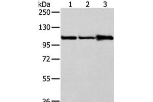 Western Blot analysis of A431, 231 and NIH/3T3 cell using AP2A1 Polyclonal Antibody at dilution of 1/250 (alpha Adaptin antibody)