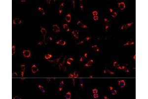Immunofluorescence analysis of L929 cells using PAH Polyclonal Antibody at dilution of 1:100. (Phenylalanine Hydroxylase antibody)