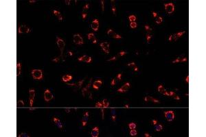 Immunofluorescence analysis of L929 cells using PAH Polyclonal Antibody at dilution of 1:100. (Phenylalanine Hydroxylase antibody)