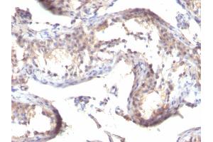 Formalin-fixed, paraffin-embedded human Testicular Carcinoma stained with TGF alpha Mouse Monoclonal Antibody (MF9) (TGFA antibody  (C-Term))