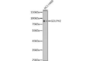 Western blot analysis of extracts of NCI-H460 cells, using GOLPH2 antibody  at 1:1000 dilution. (GOLM1 antibody)