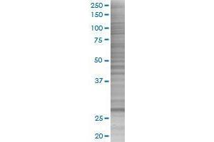 ORC6L transfected lysate. (ORC6L 293T Cell Transient Overexpression Lysate(Denatured))