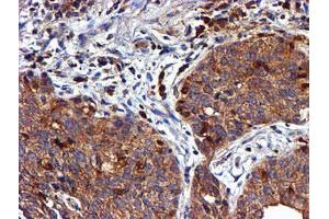 Image no. 9 for anti-LIM Domain Kinase 1 (LIMK1) antibody (ABIN1499147)