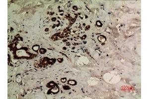 Immunohistochemical analysis of paraffin-embedded human-breast, antibody was diluted at 1:100. (alpha Tubulin antibody  (acLys40))