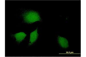 Immunofluorescence of monoclonal antibody to DNAJB9 on HeLa cell. (DNAJB9 antibody  (AA 114-223))