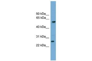WB Suggested Anti-GZMA Antibody Titration: 0. (GZMA antibody  (C-Term))