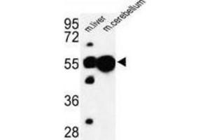 Western Blotting (WB) image for anti-Ubiquitin Associated Protein 1 (UBAP1) antibody (ABIN3003932)