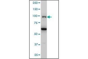 Western Blotting (WB) image for anti-Oculocerebrorenal Syndrome of Lowe (OCRL) (AA 146-240) antibody (ABIN782420)