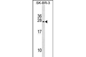 TUSC5 Antibody (Center) (ABIN1538619 and ABIN2849448) western blot analysis in SK-BR-3 cell line lysates (35 μg/lane). (TUSC5 antibody  (AA 78-104))
