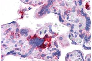 Human Placenta: Formalin-Fixed, Paraffin-Embedded (FFPE) (KIT Ligand antibody  (AA 180-229))