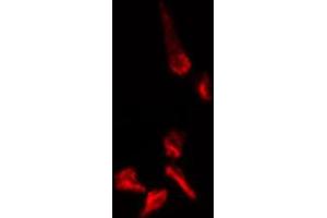 ABIN6274409 staining 293 cells by IF/ICC. (MOBKL1A antibody  (N-Term))