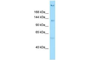 WB Suggested Anti-CEP135 Antibody Titration: 1.