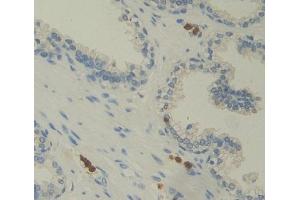 #VALUE! (Photoreceptor Cell Specific Nuclear Receptor antibody  (AA 1-410))