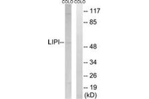 Western blot analysis of extracts from COLO cells, using LIPI Antibody. (Lipase I antibody  (AA 289-338))