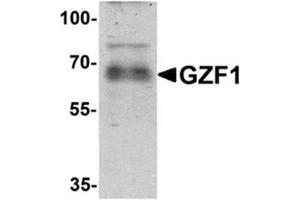 Western blot analysis of GZF1 in human heart tissue lysate with GZF1/ZNF336 Antibody  at 1 µg/ml. (ZNF336 antibody  (C-Term))