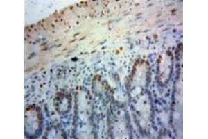 Used in DAB staining on fromalin fixed paraffin-embedded Bowels tissue (SIRT6 antibody  (AA 35-274))