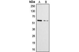 Western blot analysis of Cytochrome P450 3A4/5 expression in NCIH460 (A), HepG2 (B) whole cell lysates. (Cytochrome P450 3A4, 3A5 (Center) antibody)