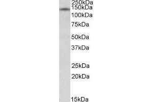 Western Blotting (WB) image for anti-Nuclear Receptor Interacting Protein 1 (NRIP1) antibody (ABIN5881688) (NRIP1 antibody)