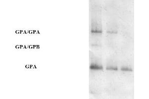 Western blot analysis using AP31671PU-N (Purified Anti-Glycophorin A pAb) at a dilution of 1/100 on human RBCs at various concentrations (GPA = Glycophorin A, GPB = Glycophorin B). (CD235a/GYPA antibody)