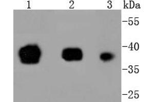 Lane 1: F9, Lane 2: NCCIT, Lane 3: hES lysates probed with Oct 4 (2D5) Monoclonal Antibody  at 1:1000 overnight at 4˚C. (OCT4 antibody)