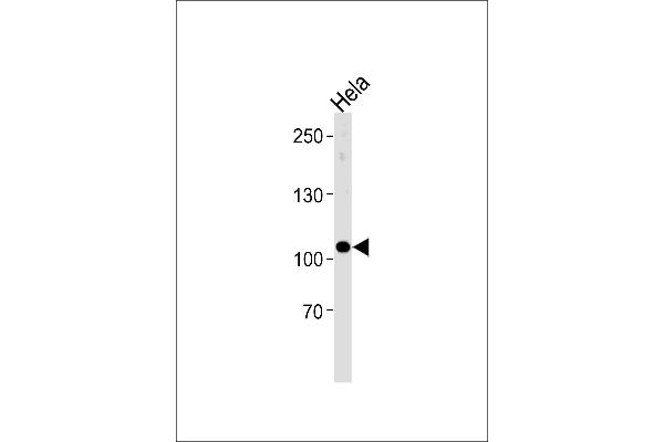 UBE3C Antikörper  (AA 549-578)